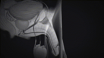 1604316597474104.gif 1568189927685328.gif